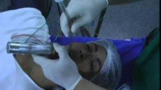 anesthesia mask ventillation ET intubation [upl. by Nolrac982]