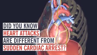 Heart Attack vs Cardiac Arrest What’s the Difference [upl. by Heiner76]