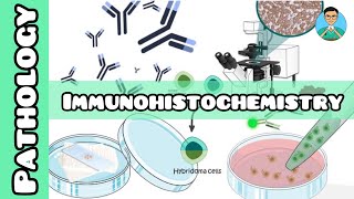 Immunohistochemistry  Pathology  USMLE NCLEX [upl. by Belding]