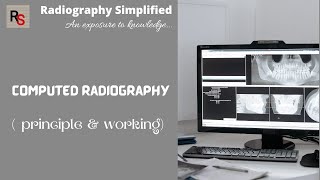 Computed Radiography  CR  ll principles amp working ll Radiography Simplified [upl. by Nyladnek]