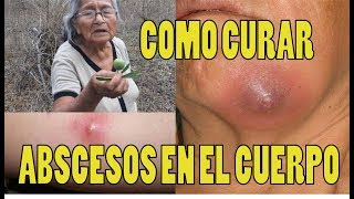 Como CURAR ABSCESOS EN EL CUERPO con Barbasco cubé  SECRETOS DE LA ABUELITA  remedio casero [upl. by Masha]