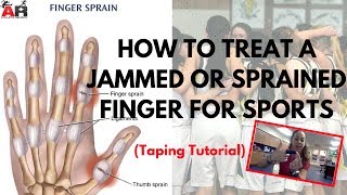 How To Treat a Jammed or Sprained Finger For Sports [upl. by Hedveh190]