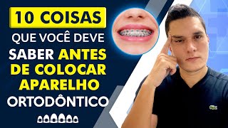 10 COISAS QUE VOCÃŠ DEVE SABER ANTES DE COLOCAR APARELHO ORTODÃ”NTICO [upl. by Keryt511]