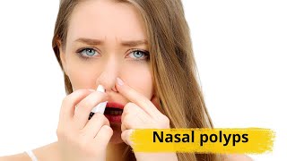 Nasal polyps Causes symptoms and treatments [upl. by Waddell101]