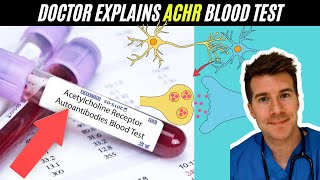 Doctor explains Acetylcholine Receptor Autoantibody blood test AChR Ab  Myesthenia Gravis [upl. by Virgina]