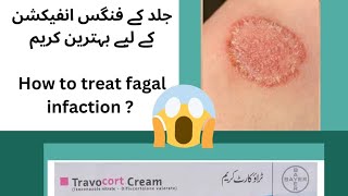 uses of travocort creamtreatment of fungal infectionfungus [upl. by Foy]