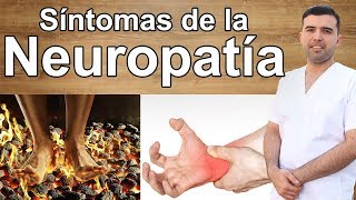 Sintomas de la Neuropatía [upl. by Rehpotsrik]