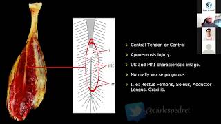 Carles Pedret Anatomy of Muscle Injuries The Utility of Imaging Tests [upl. by Findlay]