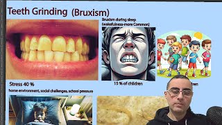 Understanding Bruxism Causes Effects and Treatments [upl. by Auburta313]