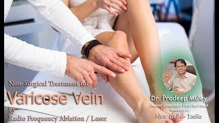 MicroPhlebectomy for Varicose Veins  VEINatlanta [upl. by Aikyn17]