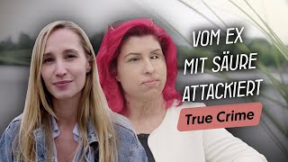 SäureAngriff überlebt Wie Vanessa nach der Attacke zu sich selbst fand [upl. by Pampuch]