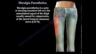 Meralgia Paresthetica  Everything You Need To Know  Dr Nabil Ebraheim [upl. by Elfstan144]