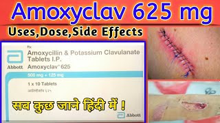 Amoxycillin and Potassium Clavulanate 625 mg Tablets IP Amoxyclav 625 mg Tablet Uses In Hindi [upl. by Rogers]