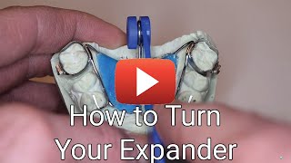 How to Turn Your Expander [upl. by Erdnaek]