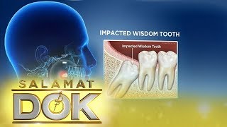 Salamat Dok Expert talks about wisdom tooth [upl. by Nyltiac]