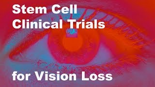 Eyeing Stem Cell Therapies for Vision Loss [upl. by Leuqer]