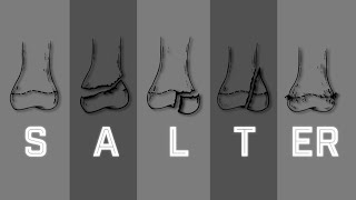 Salter Harris Fracture Classification  MEDZCOOL [upl. by Amairam]