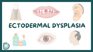 Understanding Ectodermal Dysplasia Causes Diagnosis Types and Management [upl. by Arved]