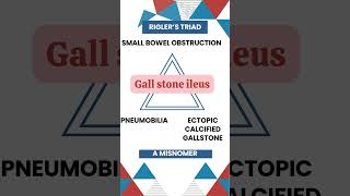 Riglers Triad Key Signs of Gallstone Ileus Explained gallbladderproblems MedicalEducation [upl. by Yasmin180]