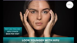 Brisbane HIFU  Face Neck amp Décolletage Lift [upl. by Bogie596]