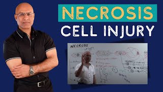 Necrosis Cell Injury  Apoptosis  General Pathology🦠 [upl. by Hussein594]