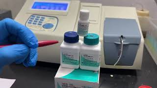 bilirubin test in hindi  bilirubin test procedure bilirubin test कैसे करे  bilirubin normal range [upl. by Dragde]