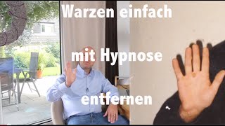 Warzen entfernen  mit Hypnose Coaching die Warzen einfach und schmerzfrei loswerden [upl. by Vicky]