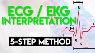 ECG Interpretation Made Easy  ECG EKG Interpretation Part 2 [upl. by Pampuch]