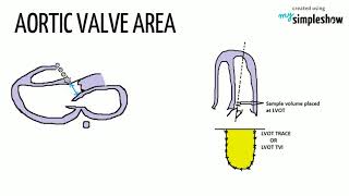 CONTINUITY EQUATION IN ECHOCARDIOGRAPHYHEART AND TECHY [upl. by Lai]