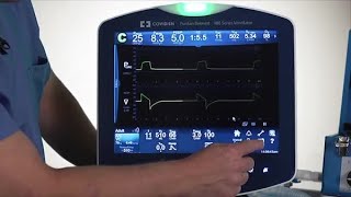 Puritan Bennett™ 980 Ventilator Basic Lesson Constant Access Icons [upl. by Amesari976]