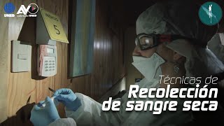 Técnica de Recolección de Sangre Seca [upl. by Steffie]