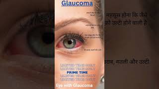 Glaucoma Symptoms docter video medical medicine trending facts [upl. by Diogenes]