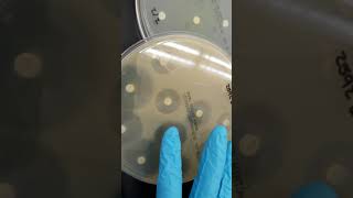 Microbiology Antibiotic Susceptibility Resistance and ESBL Part 1 [upl. by Niawtna]