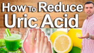 Detoxify Uric Acid and Heal Gout Completely  Uric Acid Treatment Foods and Natural Remedies [upl. by Jeniece545]