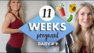 10 signs youre pregnant [upl. by Wengert]