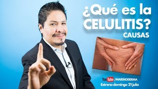 ¿Que es la celulitis y cuales son sus causas Dr Marino Dermatólogo [upl. by Alliuqet]