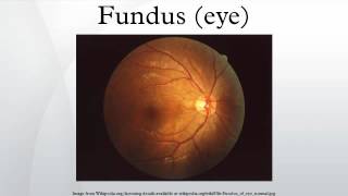 Fundus eye [upl. by Figone798]