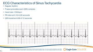 Sinus Tachycardia [upl. by Strage]