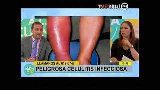 Celulitis infecciosa Dr Carlos Echevarria [upl. by Anaehs]