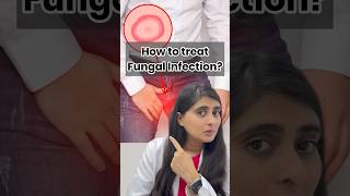 Fungal infection on skin  Ointment for fungal infection  Fungal infection in private parts [upl. by Notlim]