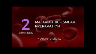 Malaria Thick Smear Preparation [upl. by Neelya]