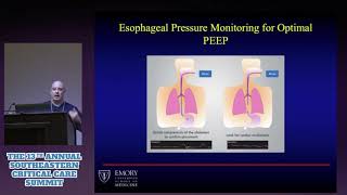 Alveolar Pressure and Pleural Pressure [upl. by Learrsi770]