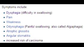 PlummerVinson Syndrome amp Esophageal Squamous Cell Carcinoma [upl. by Wernick278]