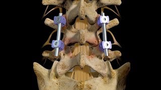 How Does a Needle Biopsy Work [upl. by Nnaeitak]