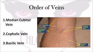 Phlebotomy The Order of Veins [upl. by Gnilrits282]