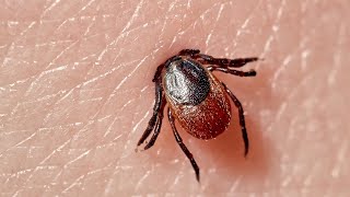 How To Remove a Tick [upl. by Anitnatsnoc]