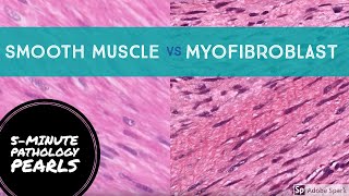 Myofibroblasts vs Smooth Muscle Made Easy 5Minute Pathology Pearls [upl. by Dory]