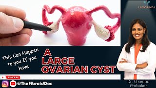 This Can Happen to you If you have A Large Ovarian Cyst  TheFibroidDoc  Dr Cheruba Prabakar [upl. by Angelico140]