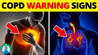 Top Early Warning Signs of COPD That Your MUST NEVER Ignore [upl. by Gilbert765]