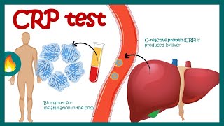 CReactive Protein CRP  Inflammation  Acute phase reactant  How do you read CRP test results [upl. by Senga252]